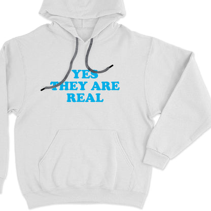Yes, they are real